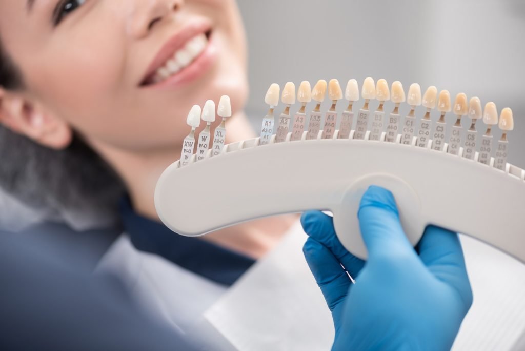 The Advantages Of Getting A Dental Crown UK Speak